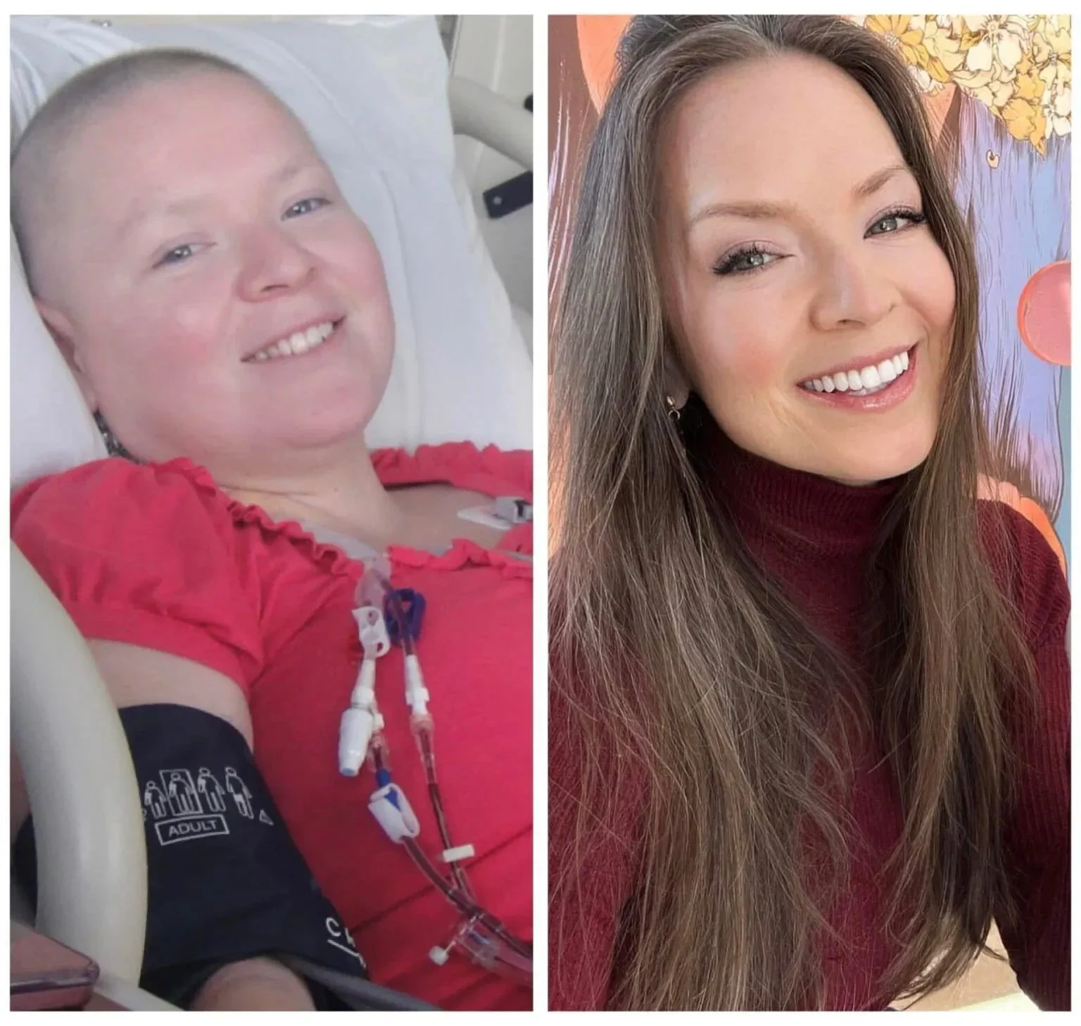 Candice Stinnett, founder of Emerald Organics, shown in two photos side by side: at left during her Stage 4 lymphoma treatment; at right, healthy and smiling today.